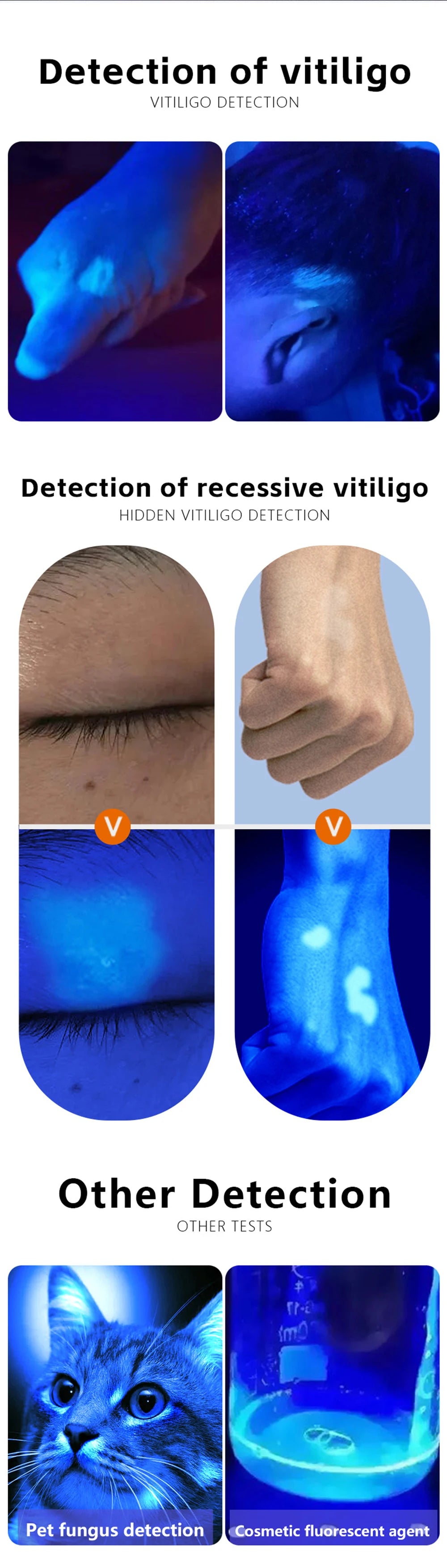 NEW Woods Lamp Skin Analyzer For Skin UV Magnifying For Beauty Facial Testing Wood Lamp Light Skin Analysis Detection Skin Care