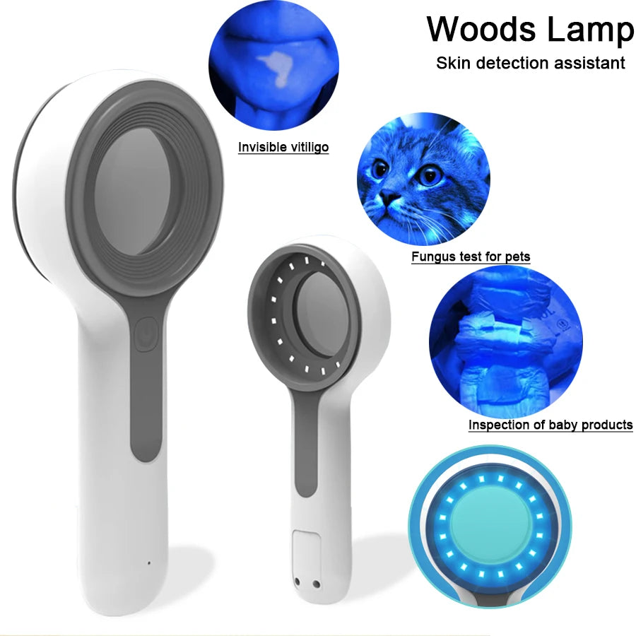 Skin Analyzer Skin Examination Beauty Test Medical Wood's Lamp Dermoscope Medical Woods Lamp Skin Analysis Vitiligo Detector