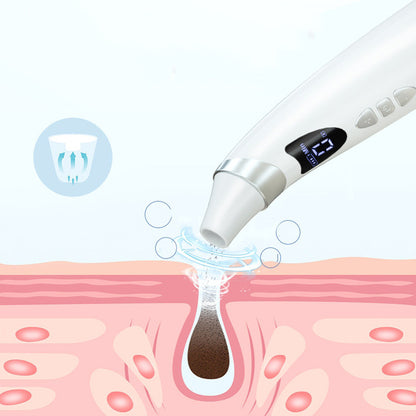 Diagram of blackhead remover suction action on a pore