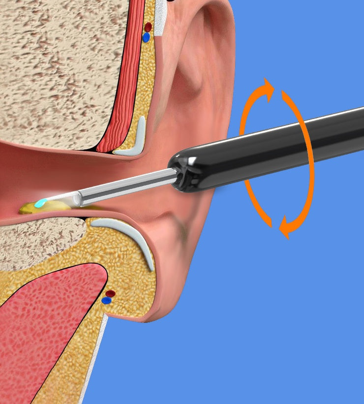 LED Ear Endoscope with Four Interchangeable Spoon Heads