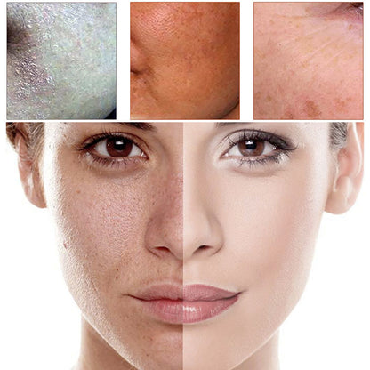 Close-up comparison of skin before and after treatment, showing improved texture and clarity.