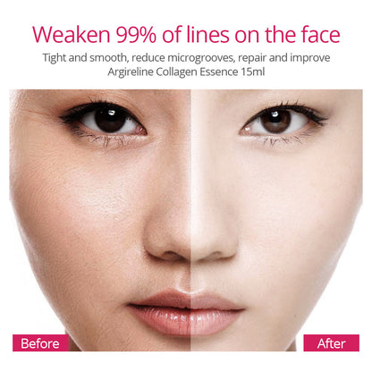 Before and after comparison of a woman face showing skin texture changes