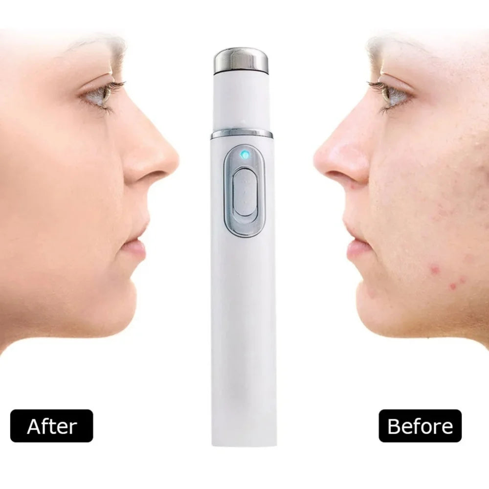 Facial Beauty Device Eye Massager Blue Light Black Eye Circles Facial Care Tool Improving Blood Circulation Maintaining Eye Bags