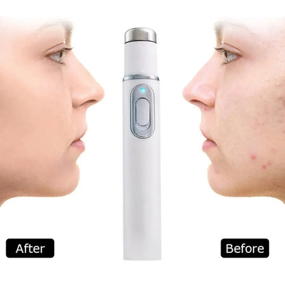 Facial Beauty Device Eye Massager Blue Light Black Eye Circles Facial Care Tool Improving Blood Circulation Maintaining Eye Bags