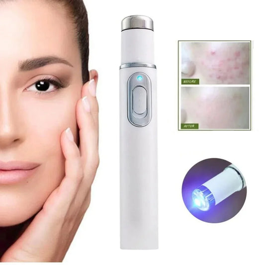 Facial Beauty Device Eye Massager Blue Light Black Eye Circles Facial Care Tool Improving Blood Circulation Maintaining Eye Bags