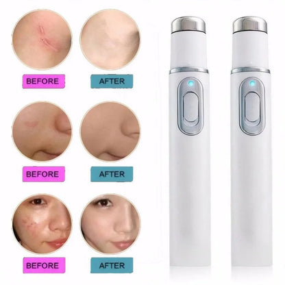 Facial Beauty Device Eye Massager Blue Light Black Eye Circles Facial Care Tool Improving Blood Circulation Maintaining Eye Bags