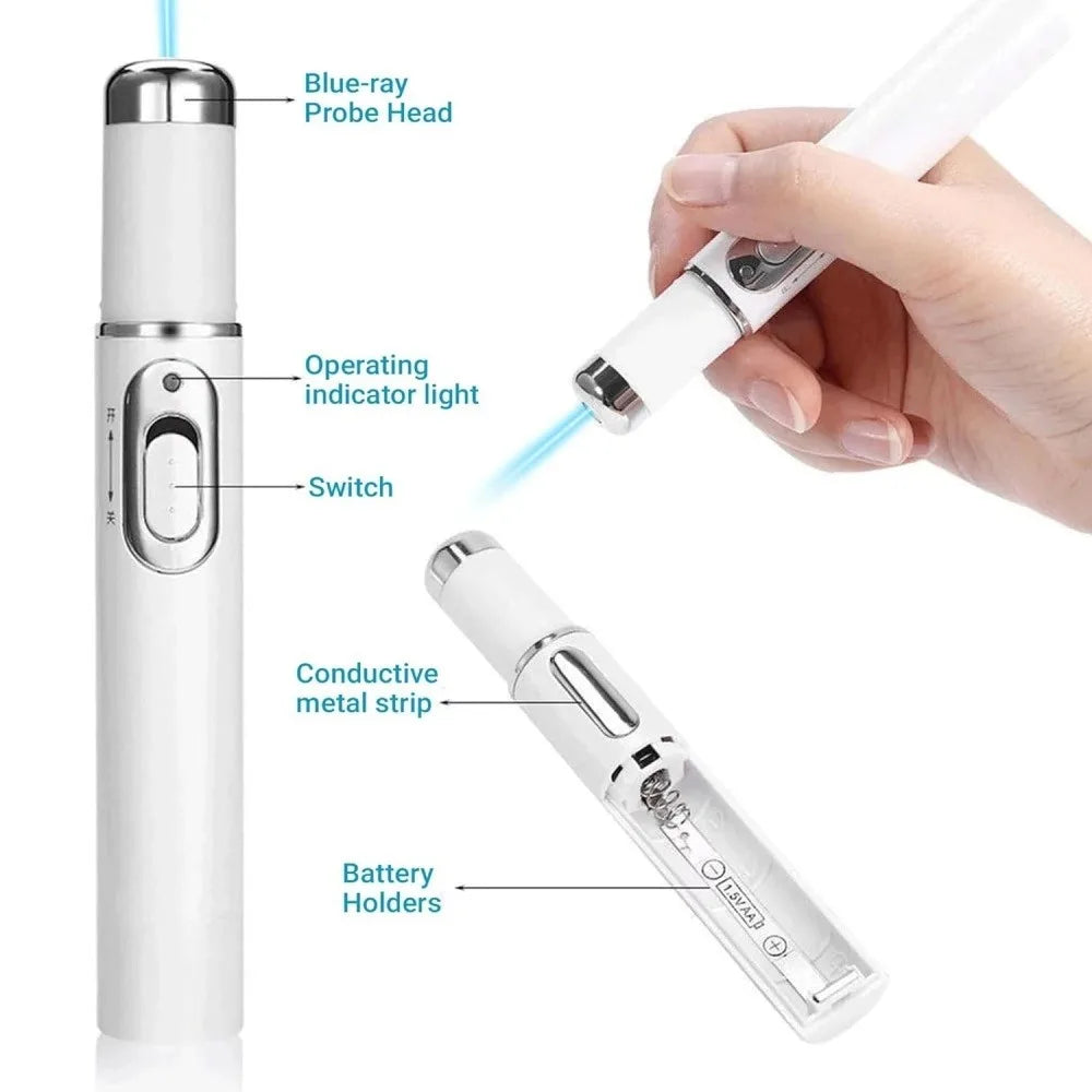 Facial Beauty Device Eye Massager Blue Light Black Eye Circles Facial Care Tool Improving Blood Circulation Maintaining Eye Bags