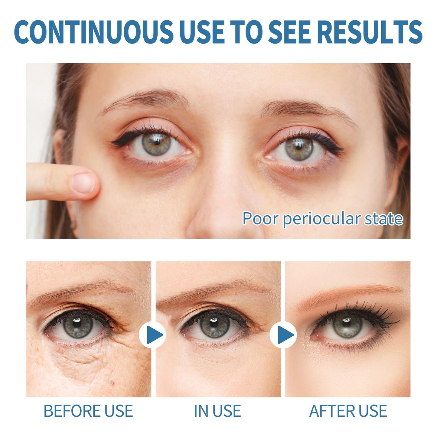 Eye Gel Patch Elastic Moisturizing Skin - merch gone viral.