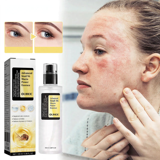 Snail mucin essence bottle beside a woman's face and before-and-after eye comparison inset.